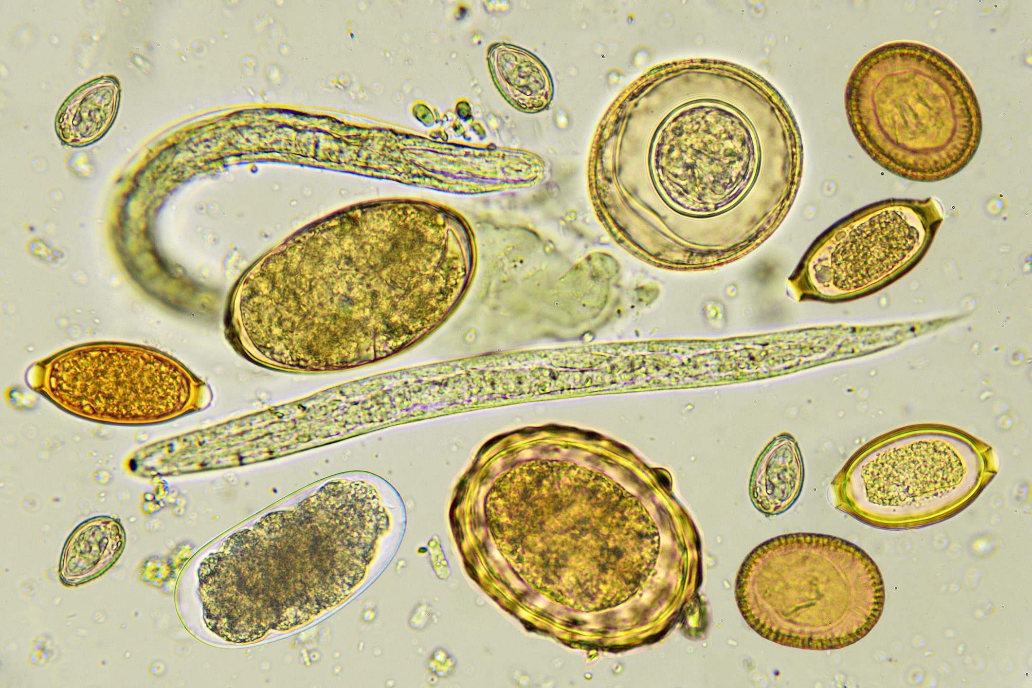 Яйца гельминтов микроскопия атлас